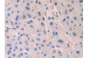 Immunohistochemistry (IHC) image for anti-CAP, Adenylate Cyclase-Associated Protein 1 (CAP1) (AA 33-218) antibody (ABIN7436249)