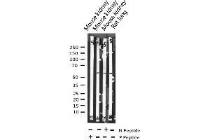 Western blot analysis of Phospho-MEF2A (Thr319) expression in various lysates