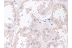 Immunohistochemistry (IHC) image for anti-Breast Cancer Anti-Estrogen Resistance 1 (BCAR1) (AA 1-240) antibody (ABIN7436351)