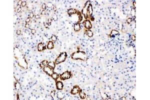 IHC-P: GLUT5 antibody testing of rat kidney tissue (SLC2A5 抗体  (Middle Region))
