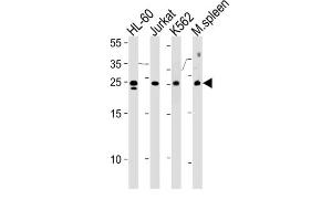 Western Blotting (WB) image for anti-Translin (TSN) antibody (ABIN2996697) (Translin 抗体)