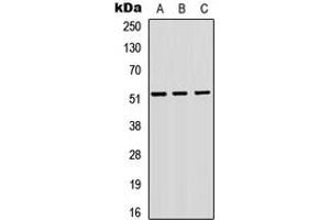 Western blot analysis of VIPR1 expression in A549 (A), H9C2 (B), Raw264. (VIPR1 抗体  (Center))