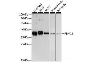 Western blot analysis of extracts of various cell lines using RBM11 Polyclonal Antibody at dilution of 1:3000. (RBM11 抗体)