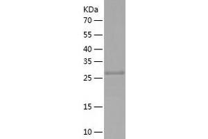 NLRC4 Protein (AA 764-1019) (His tag)