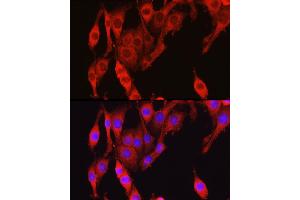 Immunofluorescence analysis of PC-12 cells using Vinculin antibody (ABIN6128911, ABIN6150070, ABIN6150071 and ABIN6218474) at dilution of 1:150. (Vinculin 抗体  (AA 767-1066))