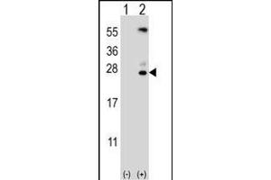 Western blot analysis of KLK6 (arrow) using rabbit polyclonal KLK6 Antibody (A13) (ABIN652195 and ABIN2840741). (Kallikrein 6 抗体  (N-Term))