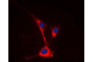 Immunofluorescent analysis of TUSC3 staining in HeLa cells. (TUSC3 抗体  (Center))