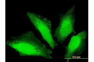 Immunofluorescence of purified MaxPab antibody to TTC15 on HeLa cell. (TTC15 抗体  (AA 1-735))