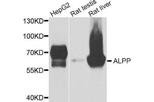 Western blot analysis of extracts of various cell lines, using ALPP antibody (ABIN5975263) at 1/1000 dilution. (PLAP 抗体)
