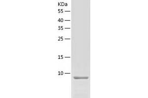 Western Blotting (WB) image for Chemokine (C-C Motif) Ligand 8 (CCL8) (AA 24-99) protein (His tag) (ABIN7122314) (CCL8 Protein (AA 24-99) (His tag))