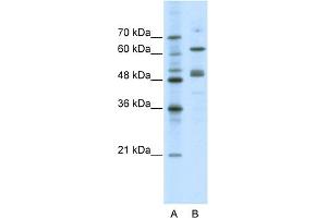 WB Suggested Anti-GATA4 Antibody Titration:  0. (GATA4 抗体  (N-Term))
