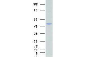 Western Blotting (WB) image for serum/glucocorticoid Regulated Kinase 1 (SGK1) (Transcript Variant 1) protein (Myc-DYKDDDDK Tag) (ABIN2731922)
