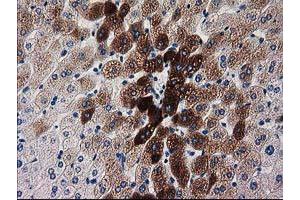 Image no. 3 for anti-Katanin P60 Subunit A-Like 1 (KATNAL1) antibody (ABIN1498985)