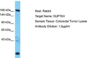 Host: Rabbit Target Name: SUPT6H Sample Type: Colorectal Tumor lysates Antibody Dilution: 1. (Spt6 抗体  (C-Term))