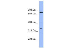WB Suggested Anti-PATZ1 Antibody Titration:  0. (PATZ1 抗体  (N-Term))