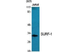 Western Blot (WB) analysis of specific cells using SURF-1 Polyclonal Antibody. (SURF1 抗体  (Internal Region))