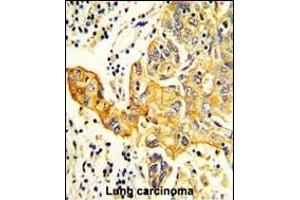 Immunohistochemistry (Paraffin-embedded Sections) (IHC (p)) image for anti-Arginyl-tRNA Synthetase 2, Mitochondrial (RARS2) (AA 369-399), (C-Term) antibody (ABIN652530)