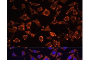 Immunofluorescence analysis of L929 cells using IL18 Polyclonal Antibody at dilution of 1:100. (IL-18 抗体)