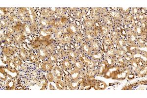 Immunohistochemistry (IHC) image for anti-Complement Fragment 3a (C3a) (AA 671-748) antibody (ABIN7439093)