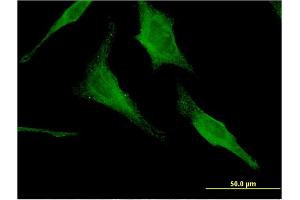 Immunofluorescence of monoclonal antibody to HEXA on HeLa cell.