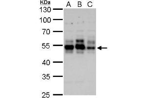 WB Image Tau antibody detects Tau protein by Western blot analysis. (MAPT 抗体)
