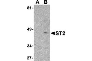 Western Blotting (WB) image for anti-Interleukin 1 Receptor-Like 1 (IL1RL1) (N-Term) antibody (ABIN1031587) (IL1RL1 抗体  (N-Term))