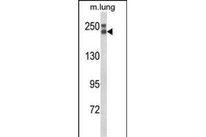 Western blot analysis of COL18A1 Antibody (N-term) (ABIN652798 and ABIN2842523) in mouse lung tissue lysates (35 μg/lane). (COL18A1 抗体  (N-Term))