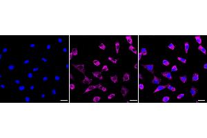 Immunocytochemical staining of Hela cells with HAPLN1 antibody (ABIN7799008), 1:1,000).