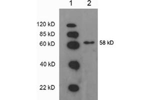 Western blot analysis: Lane 1: EasyWestern Protein Standard   Lane 2. (ATP6V1B2 抗体)