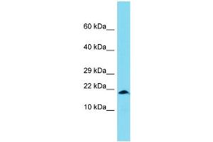 Host: Rabbit Target Name: XAGE1B Sample Type: OVCAR-3 Whole Cell lysates Antibody Dilution: 1. (XAGE1B/GAGED2 抗体  (Middle Region))