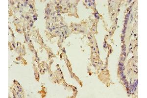 Immunohistochemistry of paraffin-embedded human lung tissue using ABIN7142610 at dilution of 1:100 (MTHFS 抗体  (AA 2-203))
