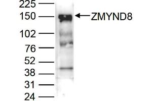 Western Blot of anti-ZMYND8 antibody Western Blot results of Rabbit anti-ZMYND8 antibody. (ZMYND8 抗体  (C-Term))