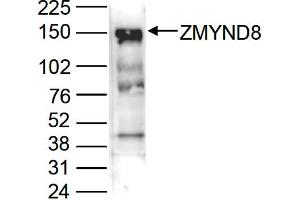 Western Blotting (WB) image for anti-Zinc Finger, MYND-Type Containing 8 (ZMYND8) (C-Term) antibody (ABIN6655406)
