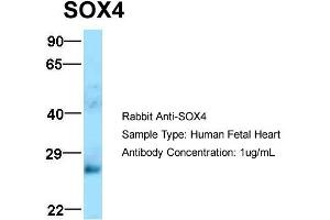 Host: Rabbit  Target Name: SOX4  Sample Tissue: Human Fetal Heart  Antibody Dilution: 1. (SOX4 抗体  (N-Term))