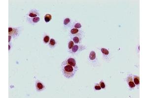 Immunocytochemistry analysis of MCF-7 cells using ABIN7139274 at dilution of 1:100 (HIST1H1E 抗体  (2meLys16))