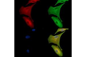 ABIN7096940 and ABIN7101006 staining  cells by IF/ICC. (TMEM63B 抗体)