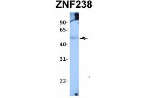 Western Blotting (WB) image for anti-Zinc Finger Protein 238 (ZNF238) (N-Term) antibody (ABIN2776459)