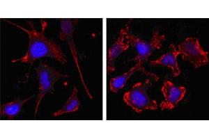 Confocal immunofluorescence analysis of SKBR-3 (left) and A549 (right) cells using beta Actin mouse mAb (red, the secondary Ab is Cy3-Goat anti mouse IgG). (beta Actin 抗体)