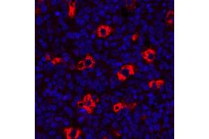 Immunofluorescence (IF) image for anti-CD68 Molecule (CD68) antibody (ABIN7449045)
