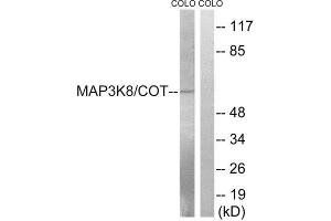 Western Blotting (WB) image for anti-Mitogen-Activated Protein Kinase Kinase Kinase 8 (MAP3K8) (Ser400) antibody (ABIN1848231) (MAP3K8 抗体  (Ser400))