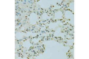 Immunohistochemistry (Paraffin-embedded Sections) (IHC (p)) image for anti-Scaffold Attachment Factor B (SAFB) (AA 1-200) antibody (ABIN6147357)
