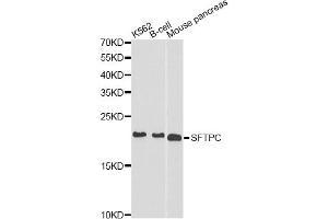 Western blot analysis of extracts of various cell lines, using SFTPC antibody. (Surfactant Protein C 抗体)