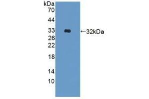 Detection of Recombinant ADAM33, Human using Polyclonal Antibody to A Disintegrin And Metalloprotease 33 (ADAM33) (ADAM33 抗体  (AA 210-503))