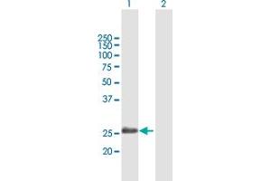 Western Blot analysis of ADH6 expression in transfected 293T cell line by ADH6 MaxPab polyclonal antibody. (ADH6 抗体  (AA 1-295))