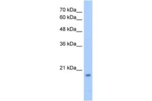Western Blotting (WB) image for anti-Deoxynucleotidyltransferase, Terminal, Interacting Protein 1 (DNTTIP1) antibody (ABIN2463366) (DNTTIP1 抗体)