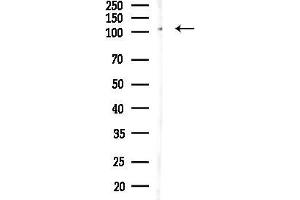 Western blot analysis of lysates from PC12 cells(heat-shock,45 min treatment), using MMS19 Antibody at 1/1000 dilution.
