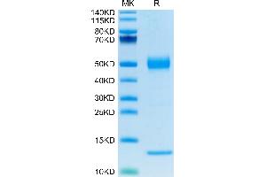 Human CD1A on Tris-Bis PAGE under reduced condition. (CD1a Protein (CD1a) (AA 19-300) (His tag))