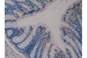 Immunohistochemistry (IHC) image for anti-Klotho (KL) (AA 516-955) antibody (ABIN7436549)