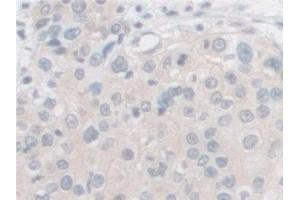 Immunohistochemistry (IHC) image for anti-Proprotein Convertase Subtilisin/kexin Type 1 (PCSK1) (AA 500-738) antibody (ABIN7435748)