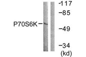 Western Blotting (WB) image for anti-Ribosomal Protein S6 Kinase, 70kDa, Polypeptide 1 (RPS6KB1) (AA 195-244) antibody (ABIN2888683) (RPS6KB1 抗体  (AA 195-244))